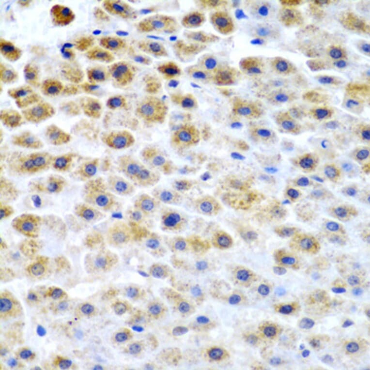 Anti-TFPI2 Antibody from Bioworld Technology (BS7966) - Antibodies.com