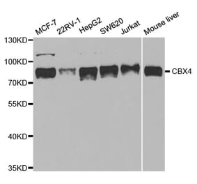 Anti-CBX4 Antibody from Bioworld Technology (BS7970) - Antibodies.com