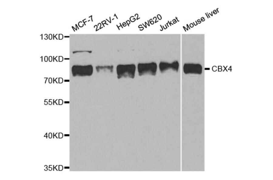 Anti-CBX4 Antibody from Bioworld Technology (BS7970) - Antibodies.com