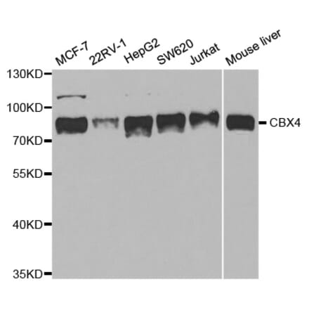 Anti-CBX4 Antibody from Bioworld Technology (BS7970) - Antibodies.com