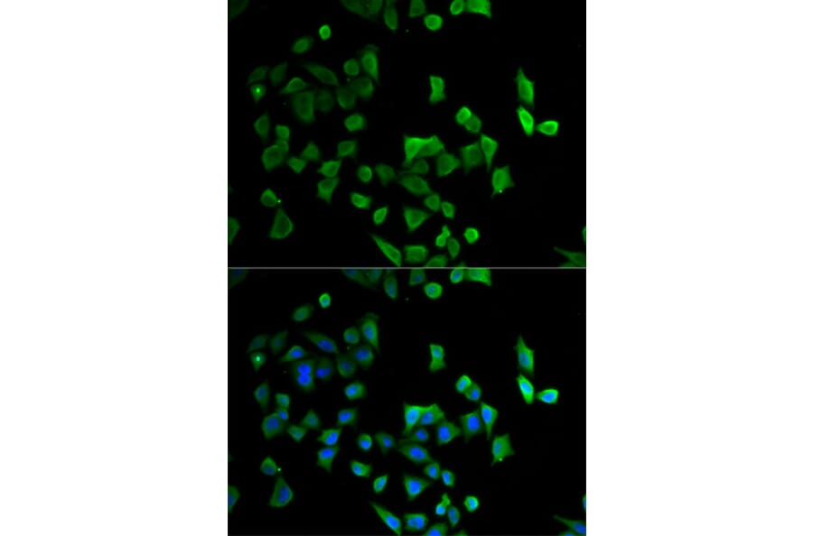 Anti-CBX4 Antibody from Bioworld Technology (BS7970) - Antibodies.com