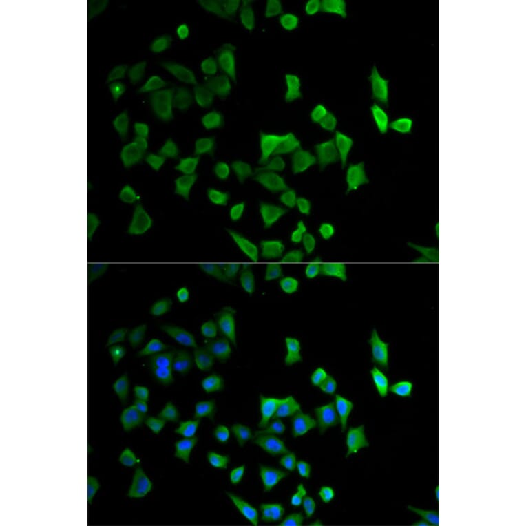 Anti-CBX4 Antibody from Bioworld Technology (BS7970) - Antibodies.com
