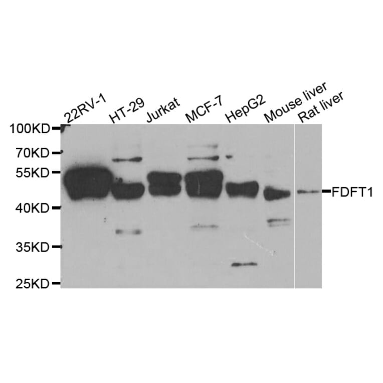 Anti-FDFT1 Antibody from Bioworld Technology (BS7976) - Antibodies.com