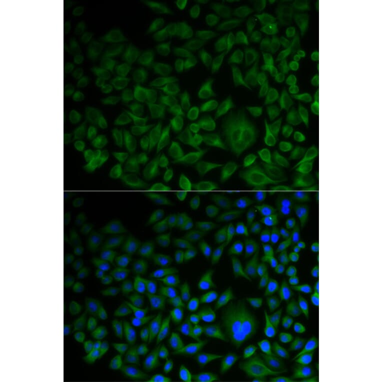 Anti-FDFT1 Antibody from Bioworld Technology (BS7976) - Antibodies.com