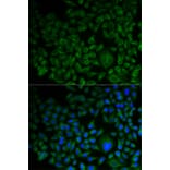 Anti-FDFT1 Antibody from Bioworld Technology (BS7976) - Antibodies.com