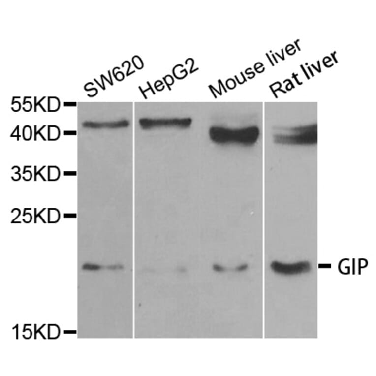 Anti-GIP Antibody from Bioworld Technology (BS7977) - Antibodies.com