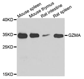 Anti-GZMA Antibody from Bioworld Technology (BS7978) - Antibodies.com