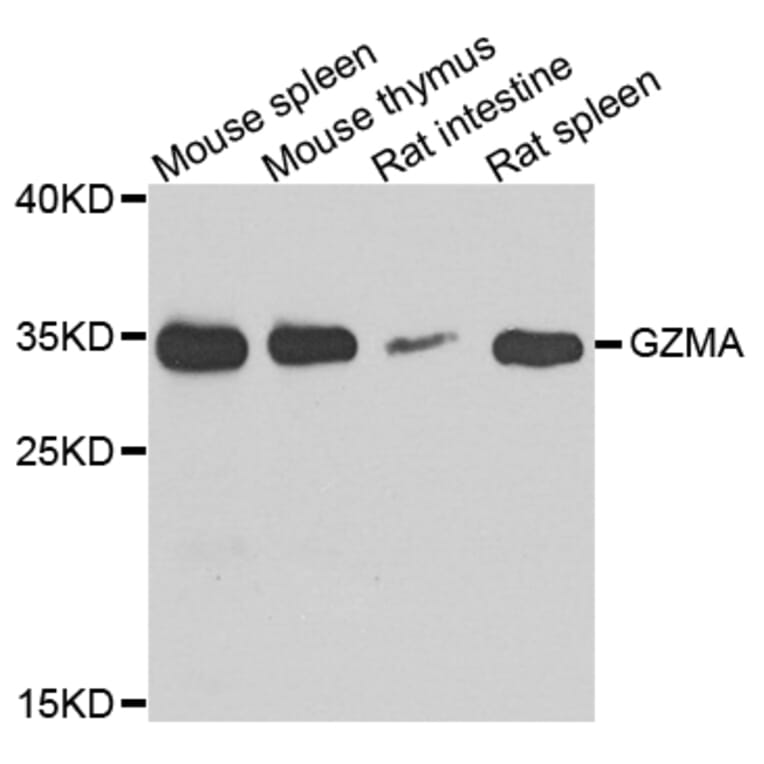 Anti-GZMA Antibody from Bioworld Technology (BS7978) - Antibodies.com