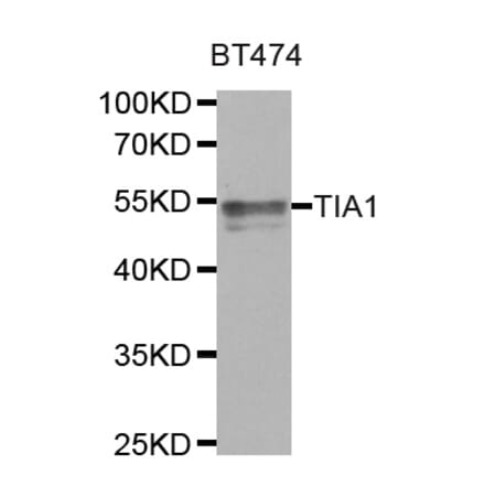 Anti-TIA1 Antibody from Bioworld Technology (BS7982) - Antibodies.com