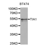 Anti-TIA1 Antibody from Bioworld Technology (BS7982) - Antibodies.com