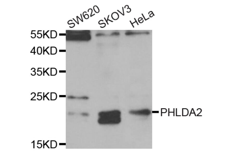 Anti-PHLDA2 Antibody from Bioworld Technology (BS7988) - Antibodies.com