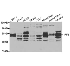 Anti-IRF6 Antibody from Bioworld Technology (BS7990) - Antibodies.com