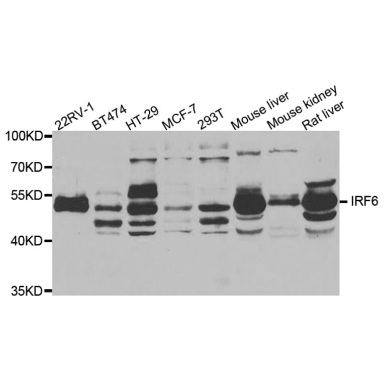 Anti-IRF6 Antibody from Bioworld Technology (BS7990) - Antibodies.com