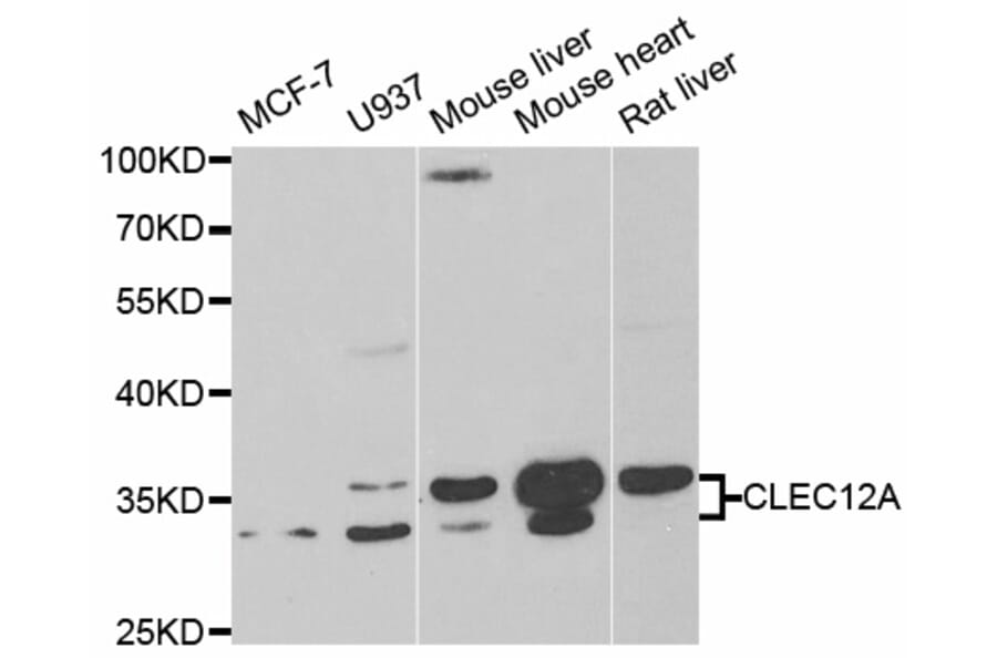 Anti-CLEC12A Antibody from Bioworld Technology (BS7992) - Antibodies.com