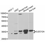 Anti-CLEC12A Antibody from Bioworld Technology (BS7992) - Antibodies.com