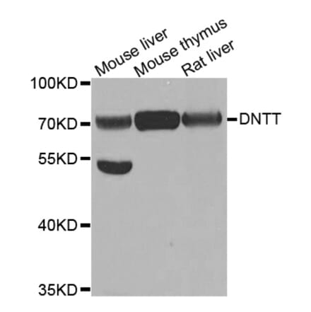 Anti-DNTT Antibody from Bioworld Technology (BS7996) - Antibodies.com