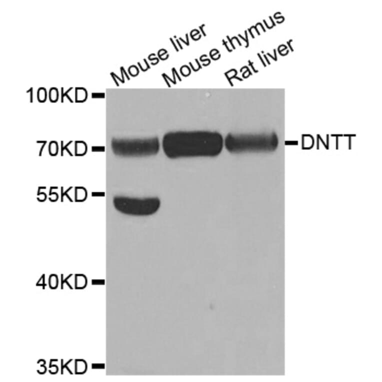 Anti-DNTT Antibody from Bioworld Technology (BS7996) - Antibodies.com
