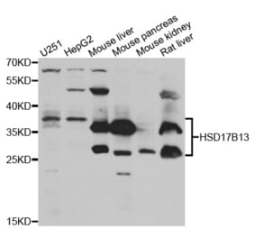 Anti-HSD17B13 Antibody from Bioworld Technology (BS7998) - Antibodies.com