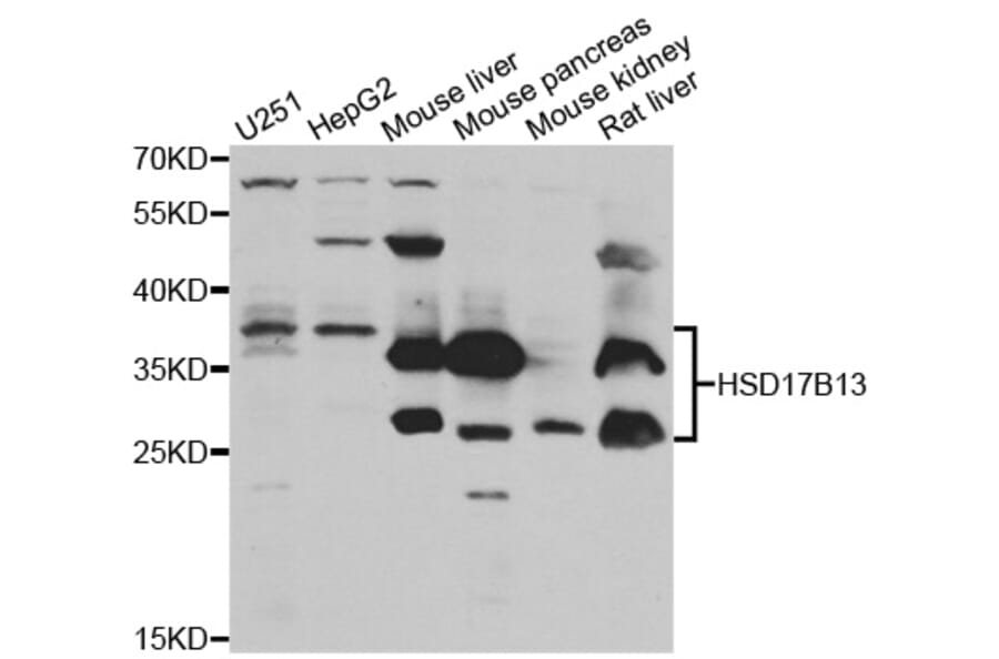 Anti-HSD17B13 Antibody from Bioworld Technology (BS7998) - Antibodies.com