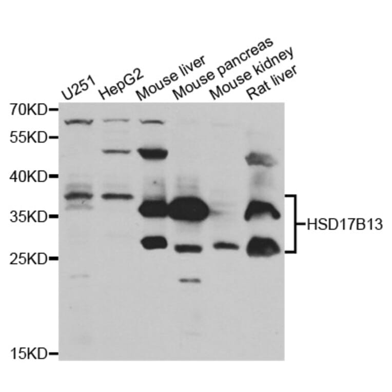 Anti-HSD17B13 Antibody from Bioworld Technology (BS7998) - Antibodies.com