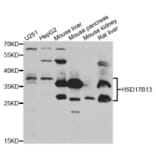 Anti-HSD17B13 Antibody from Bioworld Technology (BS7998) - Antibodies.com