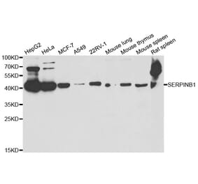 Anti-SERPINB1 Antibody from Bioworld Technology (BS7999) - Antibodies.com