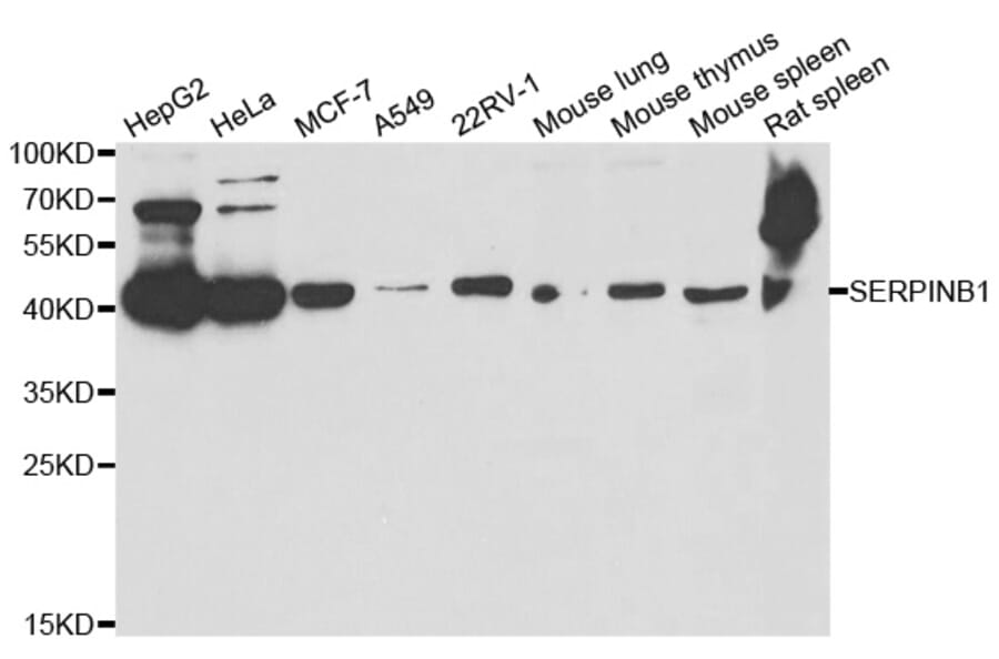 Anti-SERPINB1 Antibody from Bioworld Technology (BS7999) - Antibodies.com