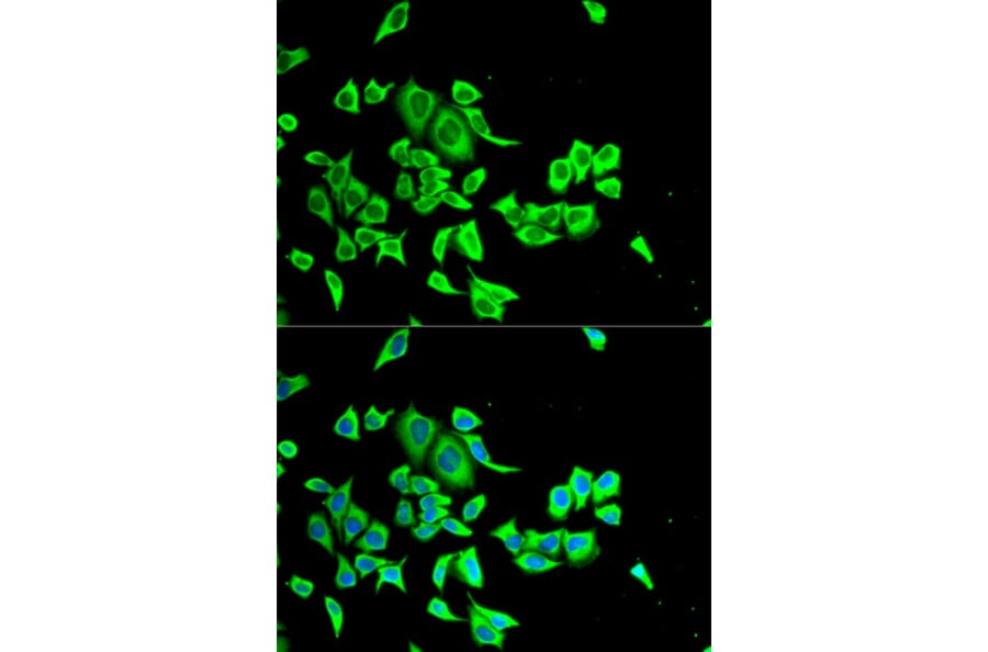Anti-SERPINB1 Antibody from Bioworld Technology (BS7999) - Antibodies.com