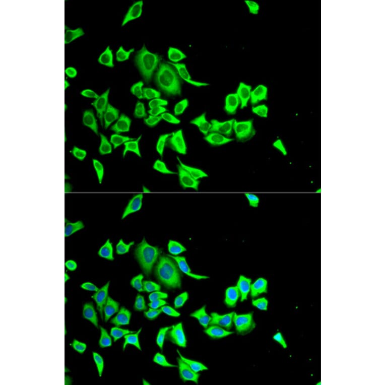 Anti-SERPINB1 Antibody from Bioworld Technology (BS7999) - Antibodies.com