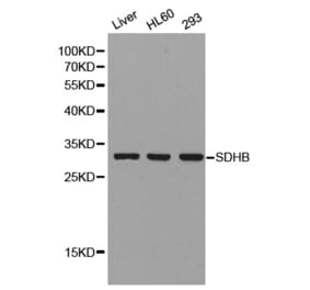 Anti-SDHB Antibody from Bioworld Technology (BS8003) - Antibodies.com