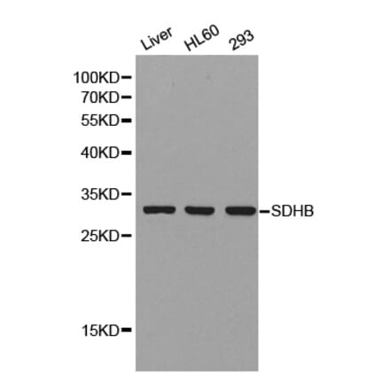 Anti-SDHB Antibody from Bioworld Technology (BS8003) - Antibodies.com