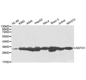 Anti-GSTO1 Antibody from Bioworld Technology (BS8004) - Antibodies.com