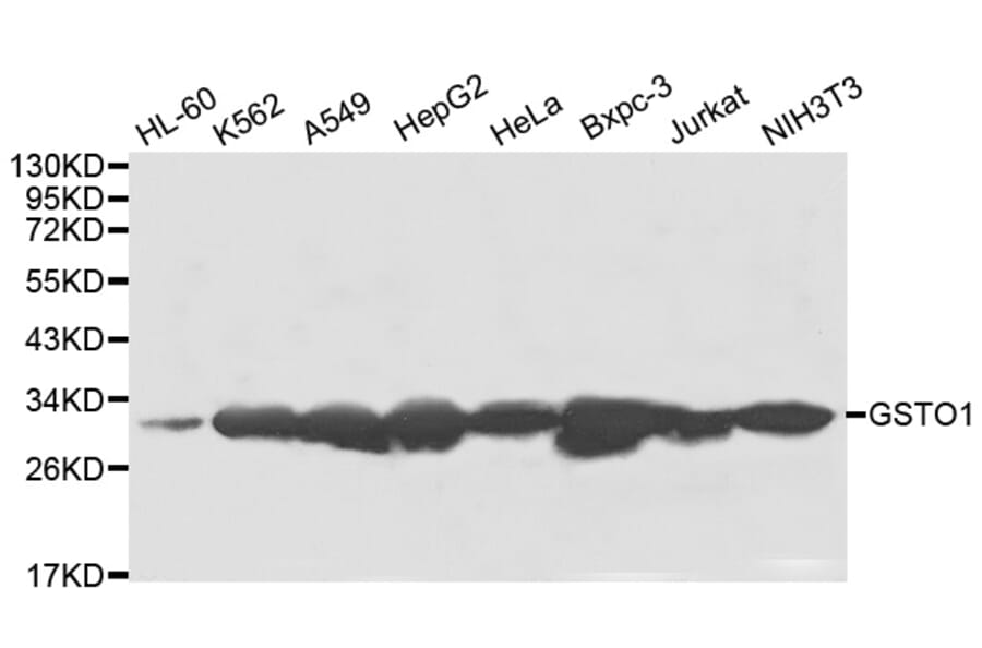 Anti-GSTO1 Antibody from Bioworld Technology (BS8004) - Antibodies.com