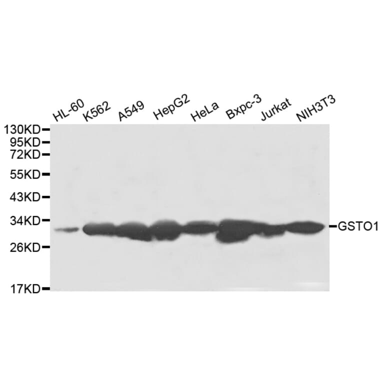 Anti-GSTO1 Antibody from Bioworld Technology (BS8004) - Antibodies.com