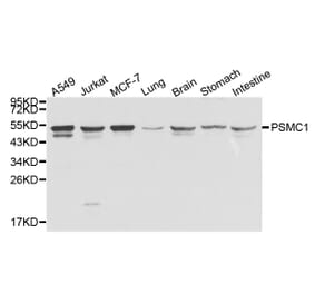 Anti-PSMC1 Antibody from Bioworld Technology (BS8005) - Antibodies.com
