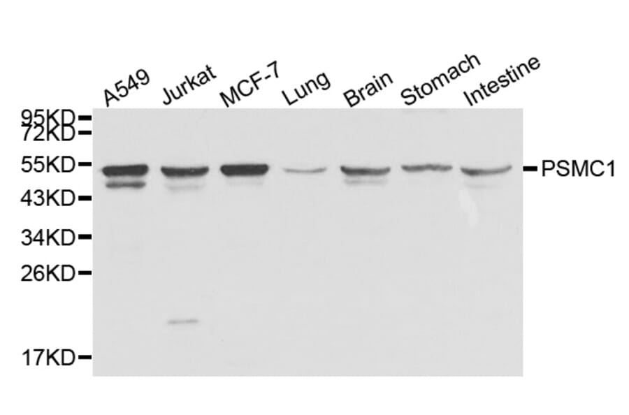 Anti-PSMC1 Antibody from Bioworld Technology (BS8005) - Antibodies.com