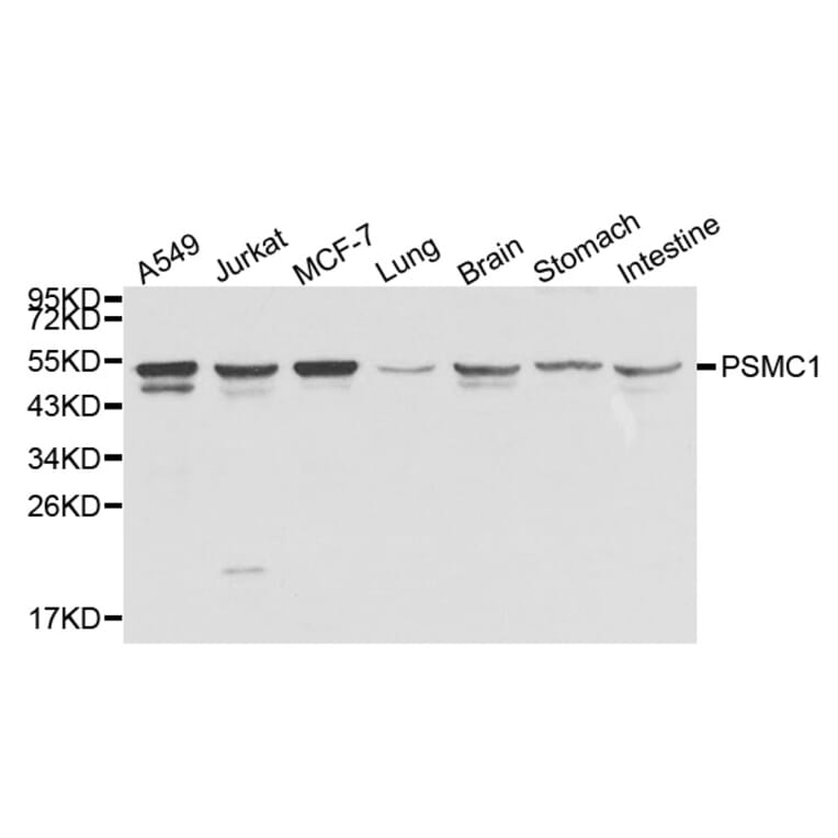 Anti-PSMC1 Antibody from Bioworld Technology (BS8005) - Antibodies.com
