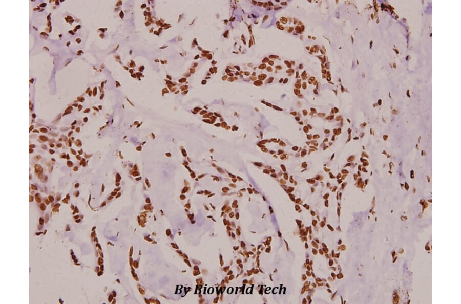Anti-Histone H3 (Acetyl-K9) Antibody from Bioworld Technology (BS8009) - Antibodies.com