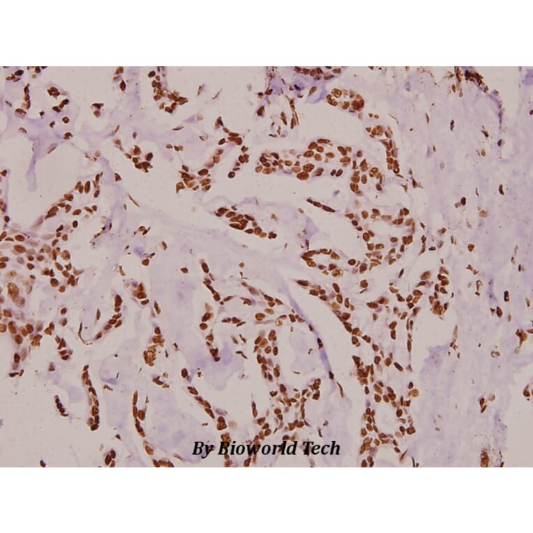 Anti-Histone H3 (Acetyl-K9) Antibody from Bioworld Technology (BS8009) - Antibodies.com