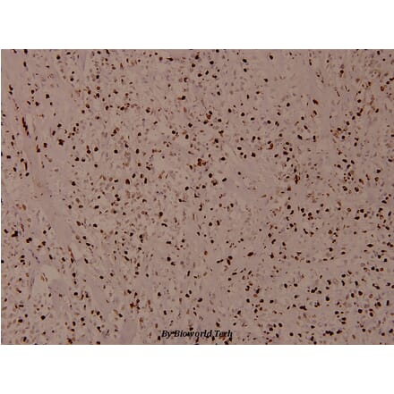 Anti-Histone H4 (Acetyl-K12) Antibody from Bioworld Technology (BS8010) - Antibodies.com