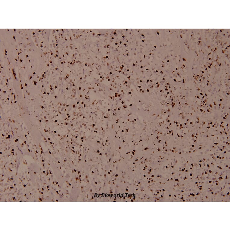 Anti-Histone H4 (Acetyl-K12) Antibody from Bioworld Technology (BS8010) - Antibodies.com