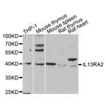 Anti-IL13RA2 Antibody from Bioworld Technology (BS8066) - Antibodies.com