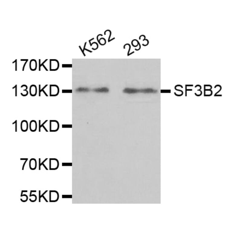 Anti-SF3B2 Antibody from Bioworld Technology (BS8070) - Antibodies.com
