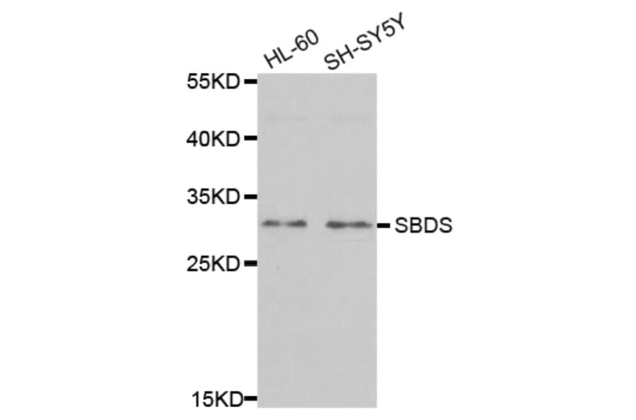 Anti-SBDS Antibody from Bioworld Technology (BS8071) - Antibodies.com