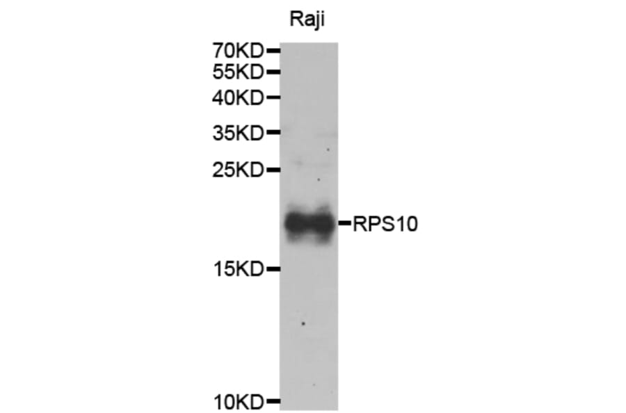 Anti-RPS10 Antibody from Bioworld Technology (BS8075) - Antibodies.com