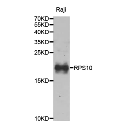 Anti-RPS10 Antibody from Bioworld Technology (BS8075) - Antibodies.com