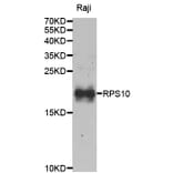 Anti-RPS10 Antibody from Bioworld Technology (BS8075) - Antibodies.com