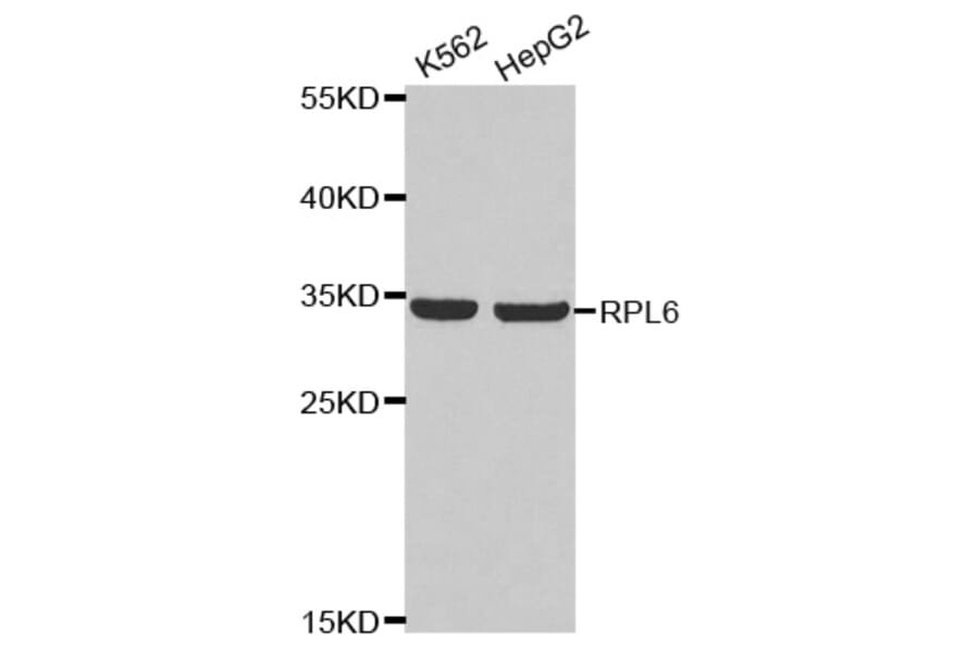 Anti-RPL6 Antibody from Bioworld Technology (BS8076) - Antibodies.com