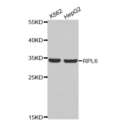 Anti-RPL6 Antibody from Bioworld Technology (BS8076) - Antibodies.com