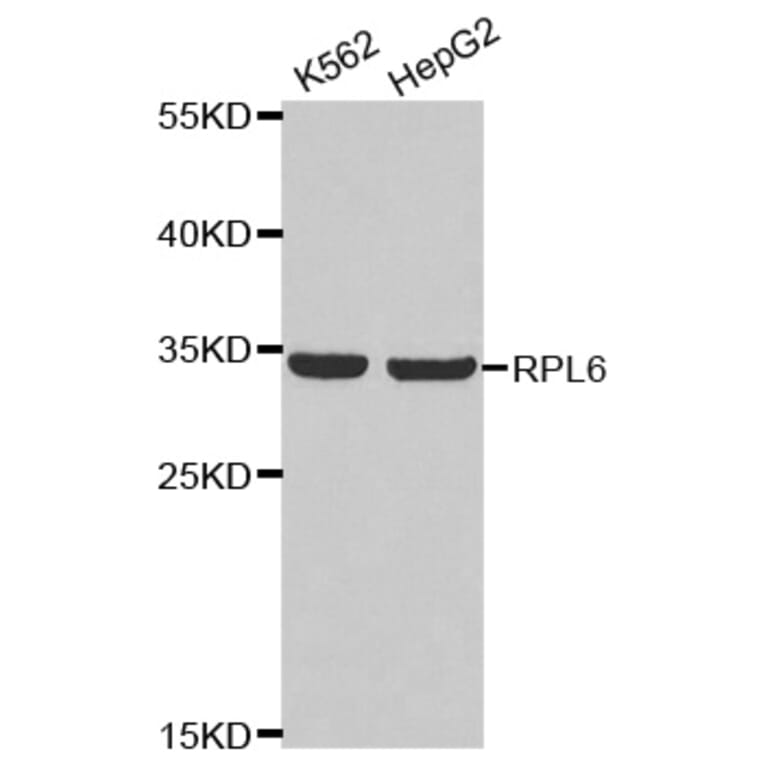 Anti-RPL6 Antibody from Bioworld Technology (BS8076) - Antibodies.com